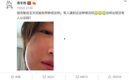 娱乐圈吃瓜爆料周冬雨